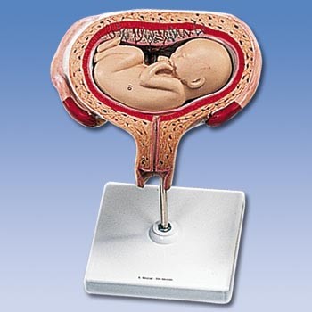 Uterus mit herausnehmbarem Fetus,