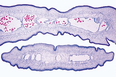 Taenia saginata, Bandwurm,