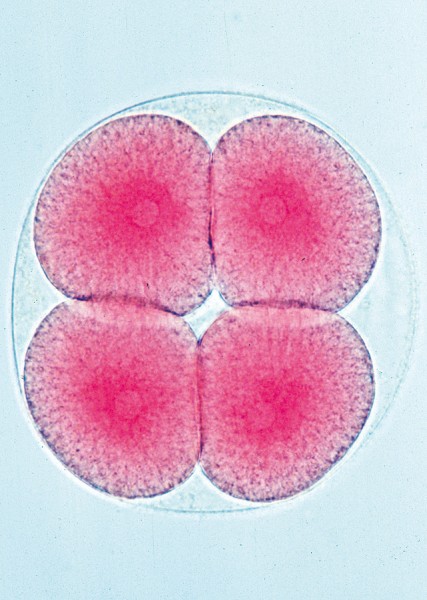 Seeigel Entwicklung I