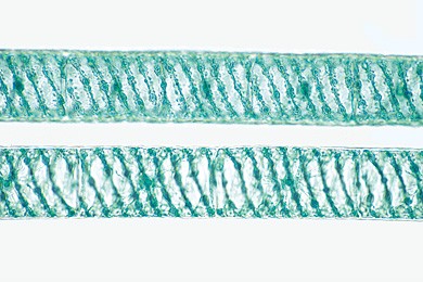 Spirogyra, Schraubenalge,