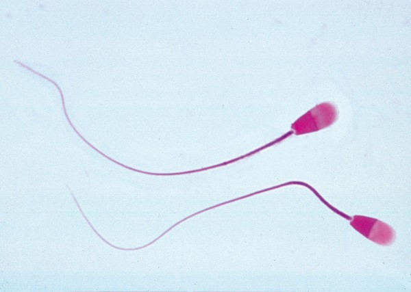 Samenfäden (Spermatozoen) vom