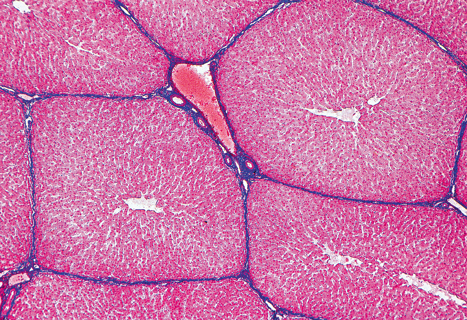 Какие клетки в печени. Клетки печени под микроскопом. Стенки печени под микроскопом.
