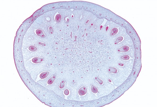 Lycopersicum (Tomate)