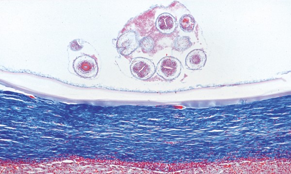 Echinococcus granulosus