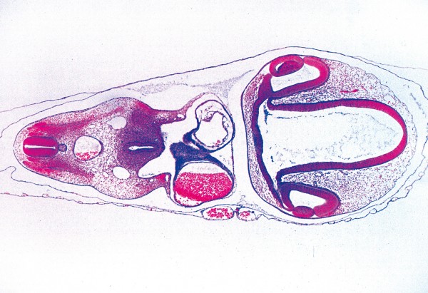 Embryo vom Huhn