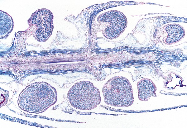 Lycopodium Pt113e