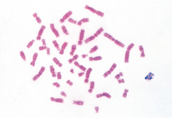 Chromosomen des Menschen im