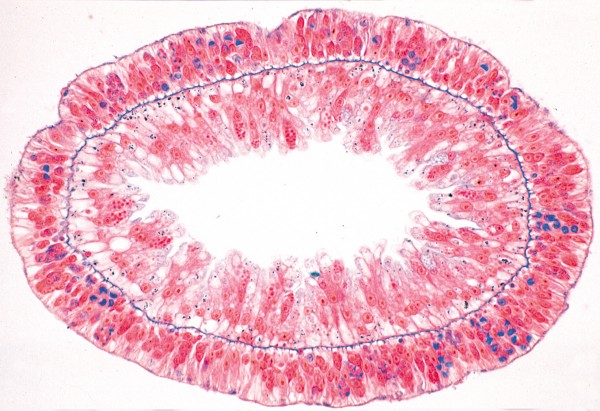 Hydra, Süßwasserpolyp, Quer-