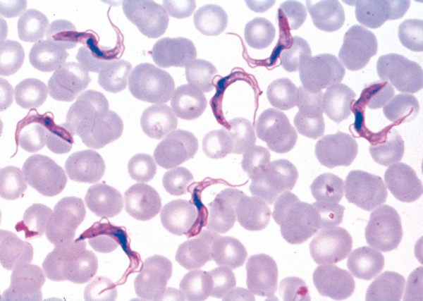 Trypanosoma gambiense, Schlaf-