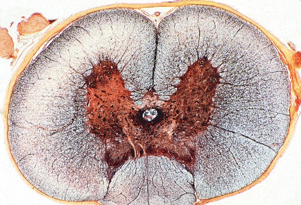 Rückenmark quer