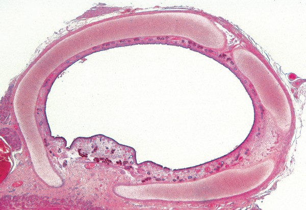 Luftröhre (Trachea)