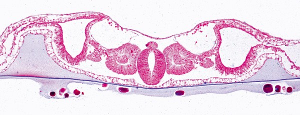 Embryo v.Huhn, 48 Stunden alt,