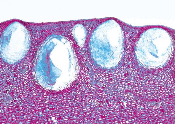 Lysigene Ölbehälter