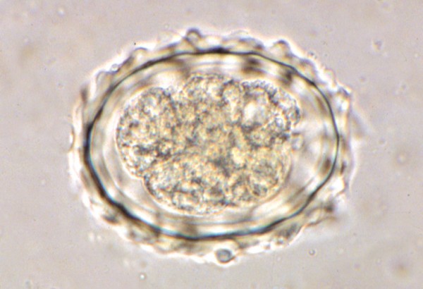 Ascaris lumbricoides (Eier