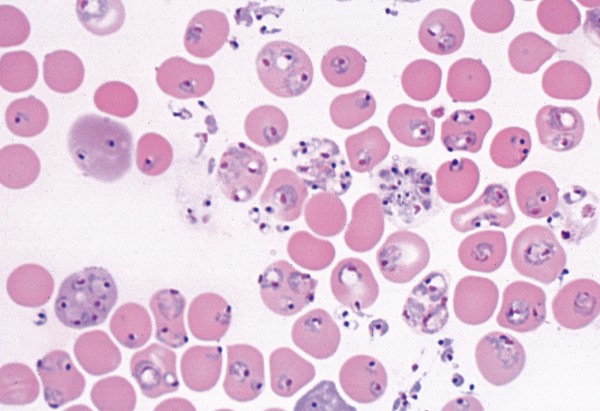 Plasmodium berghei, Malaria-