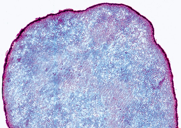 Claviceps purpurea,Mutterkorn,