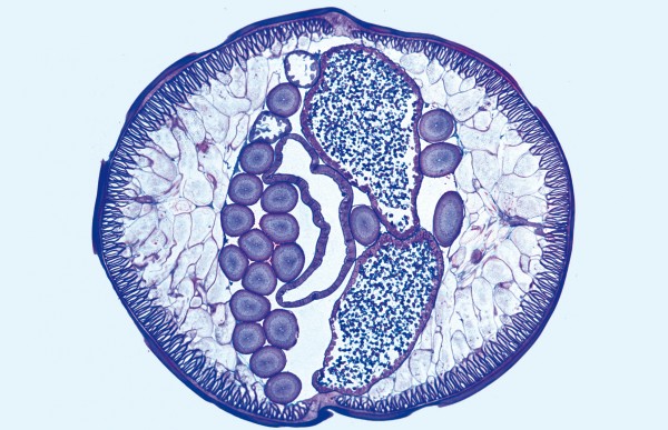 Ascaris, Spulwurm, Körpermitte