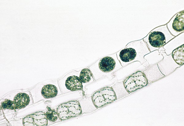 Spirogyra, Schraubenalge, in