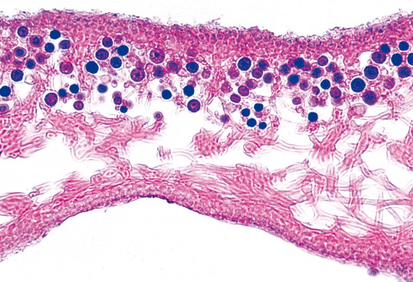 Flechte, quer. Thallus mit