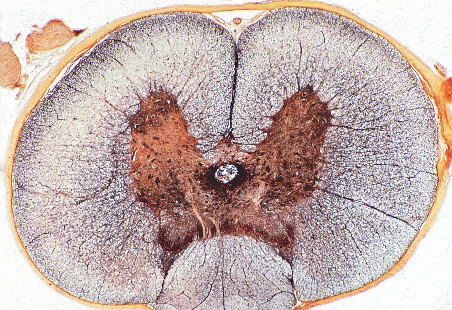 Rückenmark der Katze, quer. Graue und weiße Substanz... | LMS