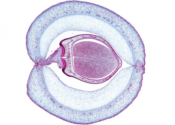 Phaseolus