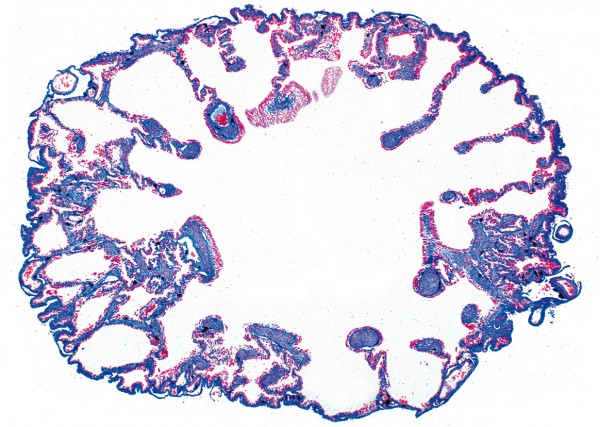 Rana (Frosch) Am212c