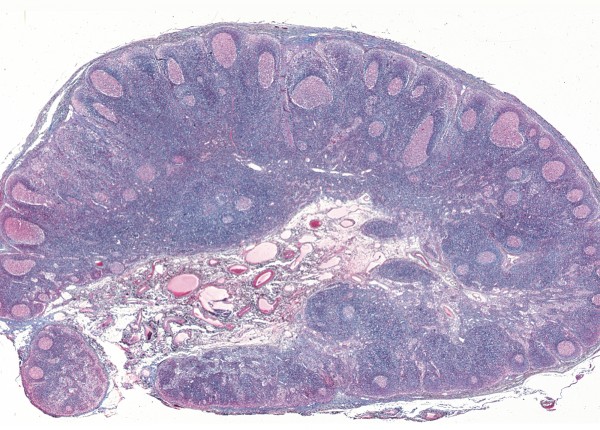 Lymphdrüse vom Schwein, quer