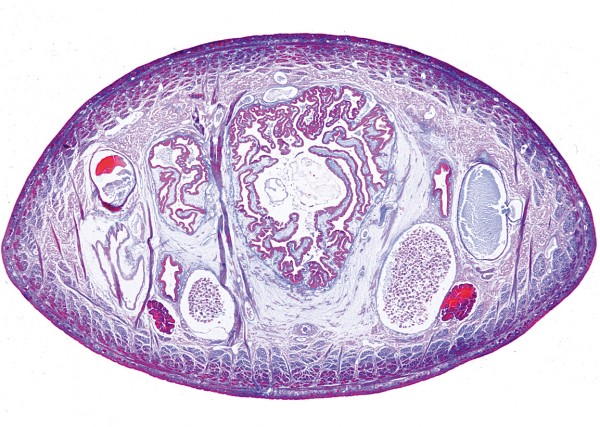 Hirudo Medicinalis