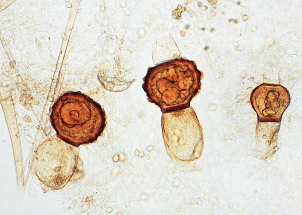 Mucor od. Rhizopus (Schimmelpilz)