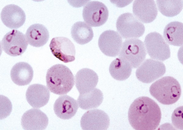 Plasmodium falciparum