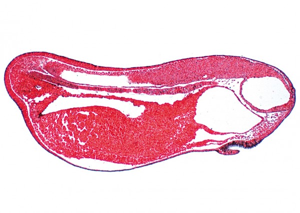 Frosch-Entwicklung: Sagittal-