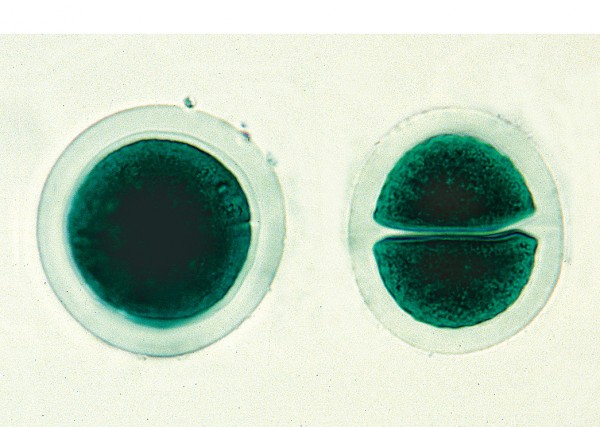 Chroococcus