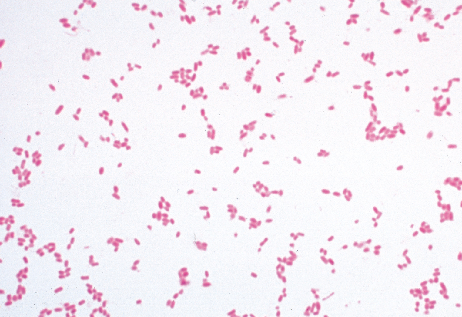 Escherichia coli, Darmbakterien, Ausstrich. Gram LMS Lehrmittel