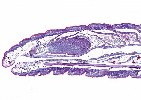 Lumbricus, Vorderende m.